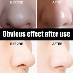 Mascarilla-Unisex-Para-Eliminar-Espinillas-Tiras-Nasales-Limpieza-Profunda-De-Poros-Pegatinas-Negras-Para-El-Cuidado-2.Webp