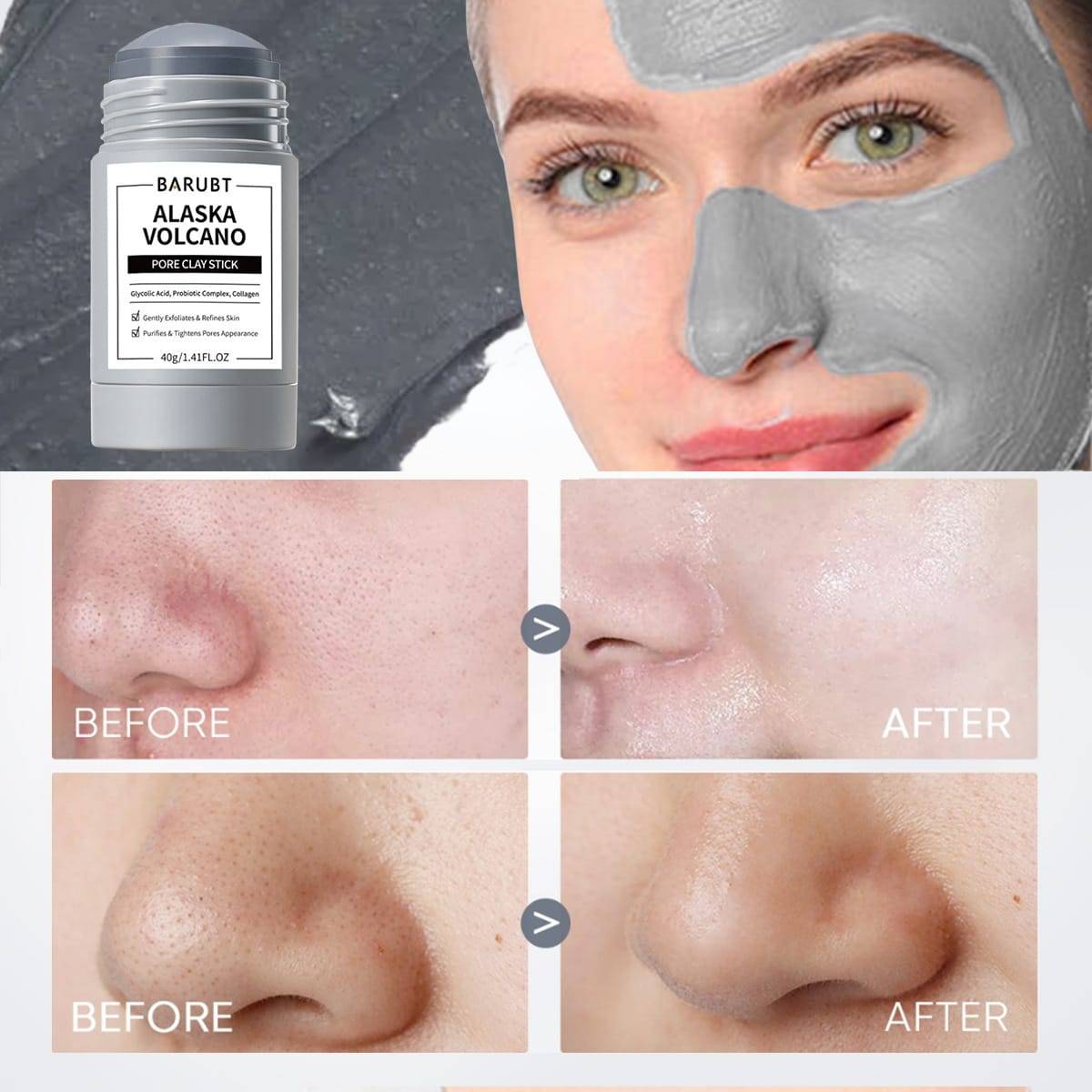 Mascarilla sólida anti-espinillas: ¡adiós a los puntos negros!