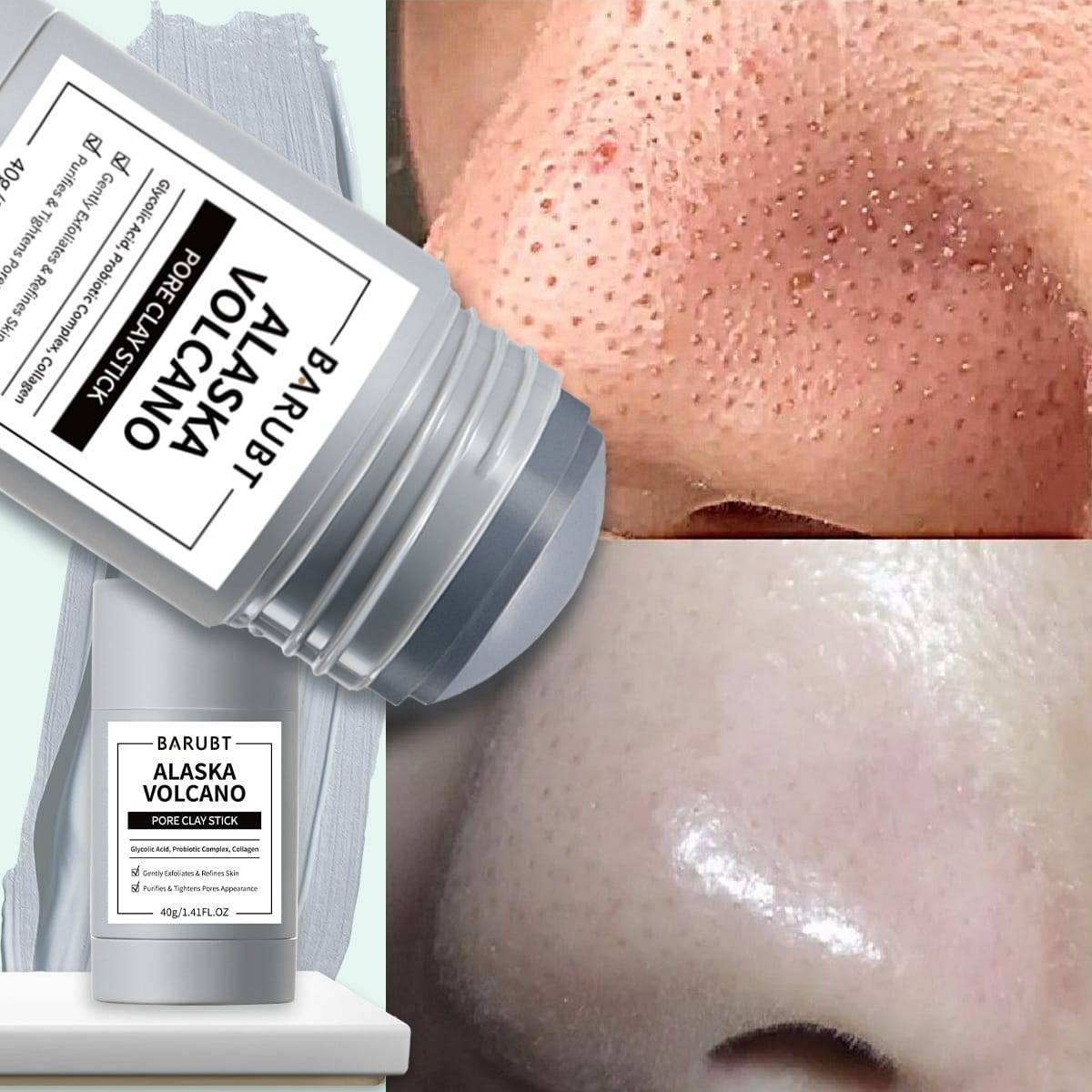 Mascarilla sólida anti-espinillas: ¡adiós a los puntos negros!