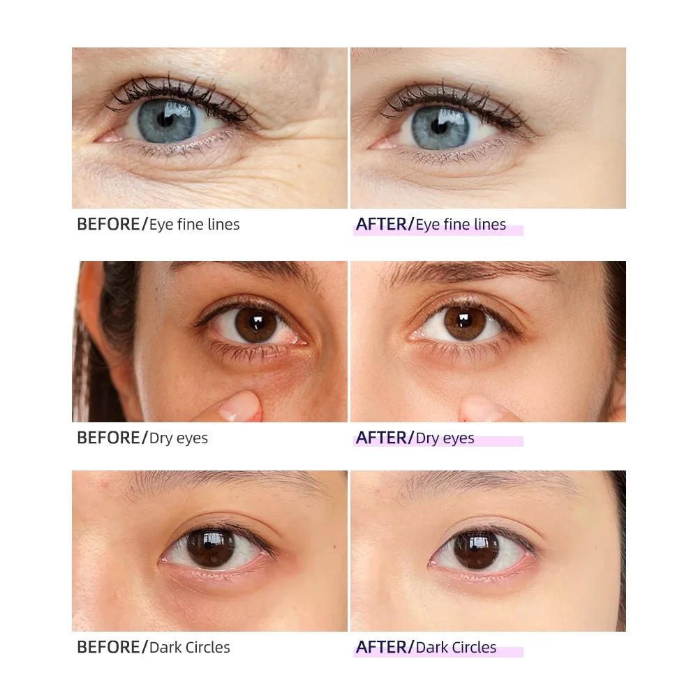 Relájate Y Alivia La Tensión Con Nuestro Masajeador De Ojos Relájate Y Alivia La Tensión Con Nuestro Masajeador De Ojos