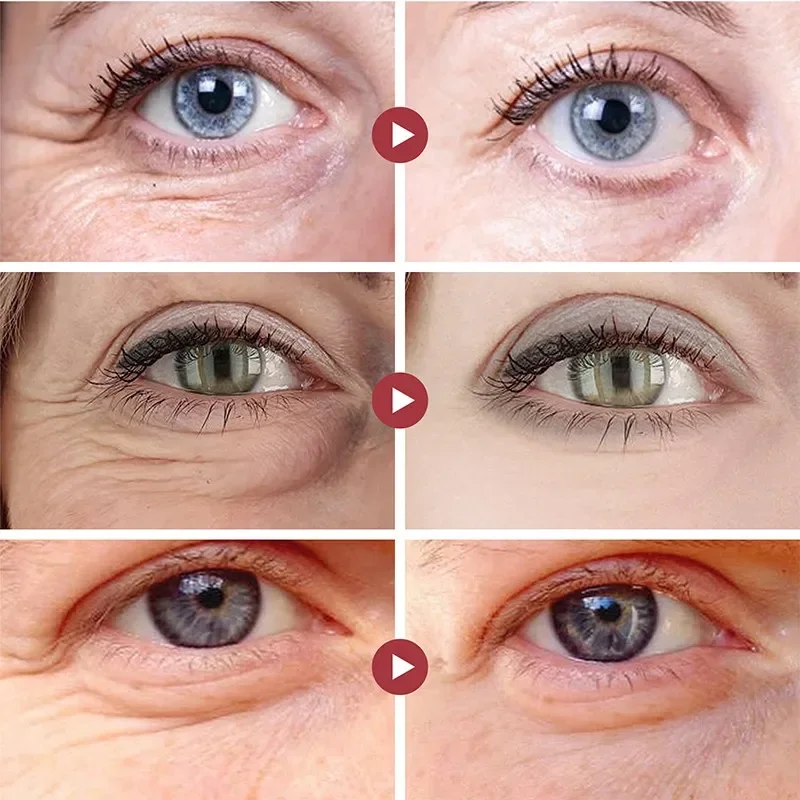Mascarilla de colágeno para ojos: rejuvenece y revitaliza tu mirada