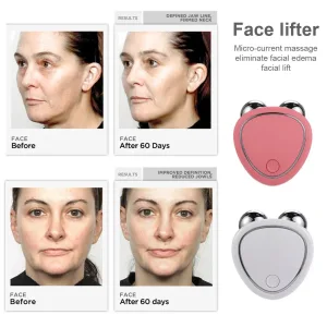 Imagen del producto Rodillo masajeador de estiramiento Facial eléctrico | Compra online en Tiendafiable
