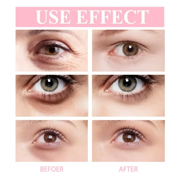 Imagen Informativa: Grandioso Crema Antiarrugas De Retinol Solución Efectiva | Tiendafiable